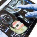 Endodoncija – liječenje kanala korijena zuba