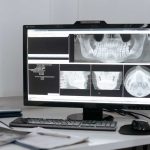Što je CBCT 3D uređaj u stomatologiji?