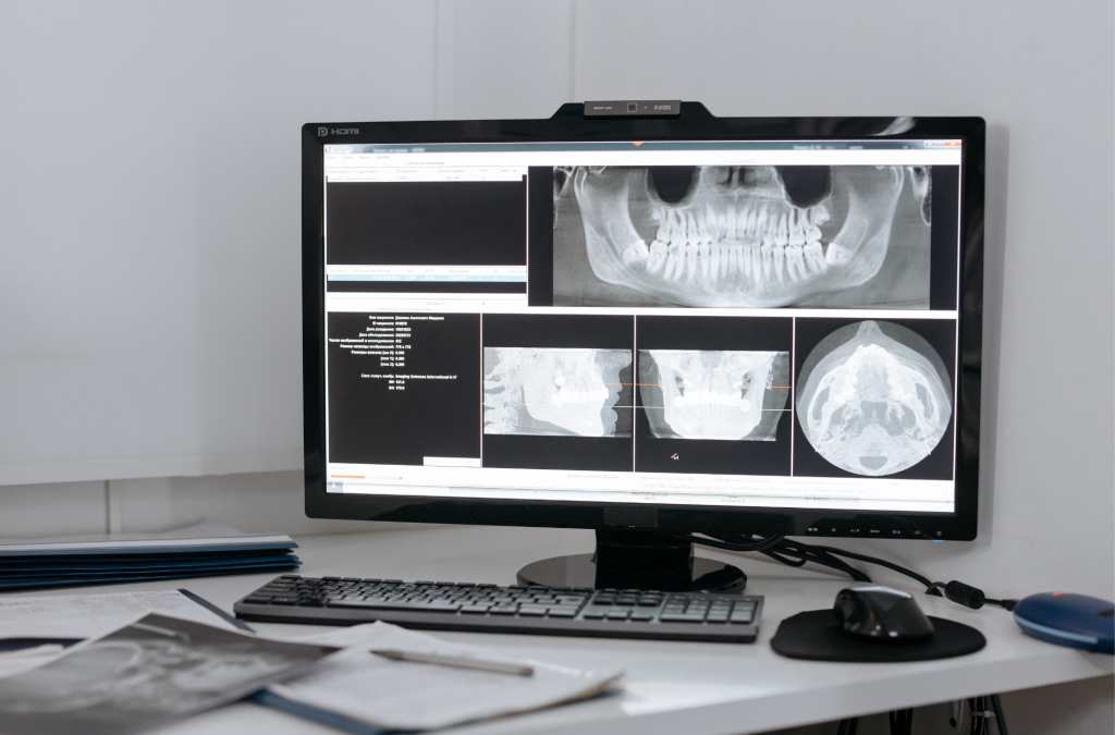 Što je CBCT 3D uređaj u stomatologiji?