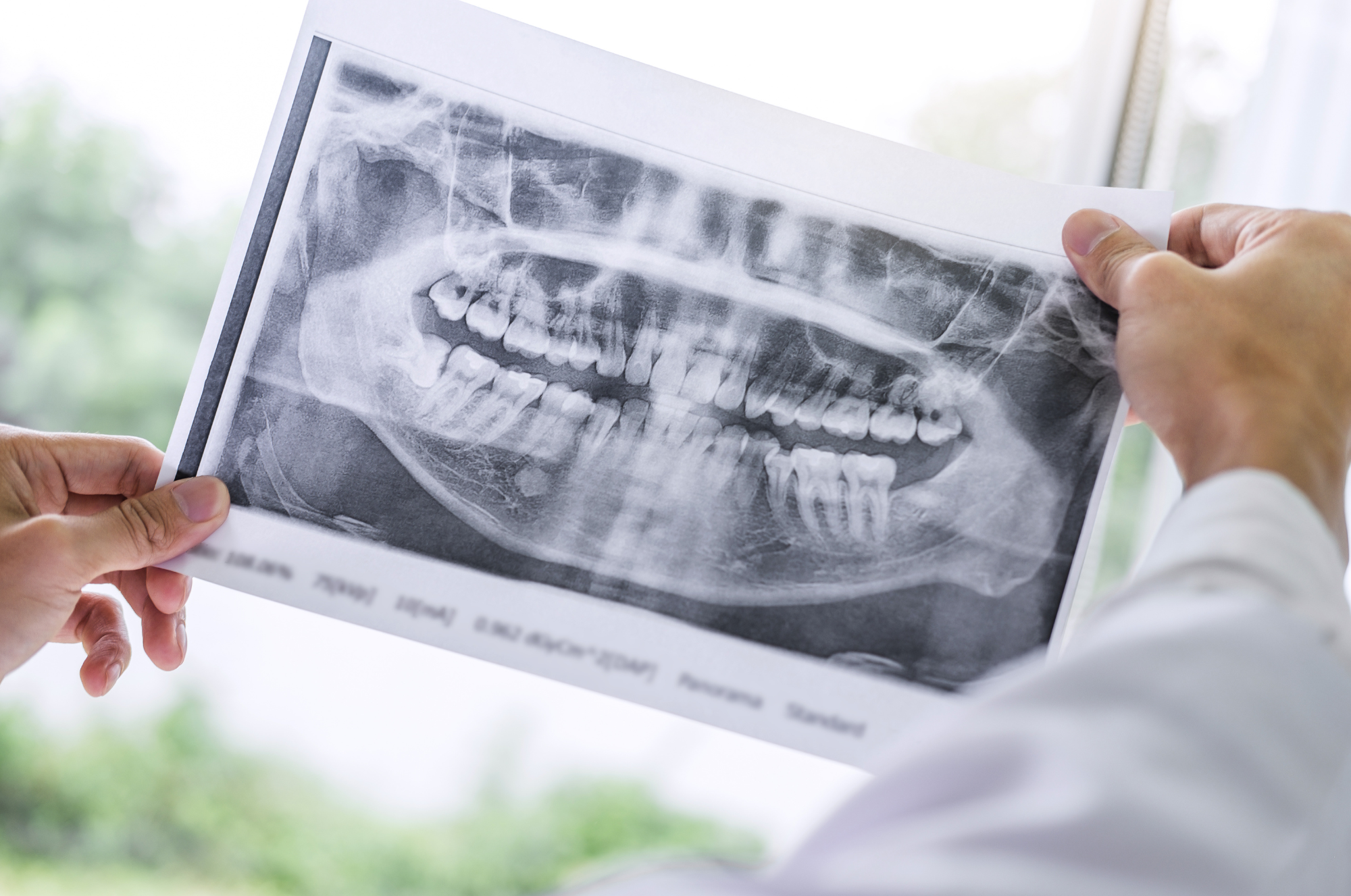 Kako je oralno zdravlje povezano s drugim bolestima?