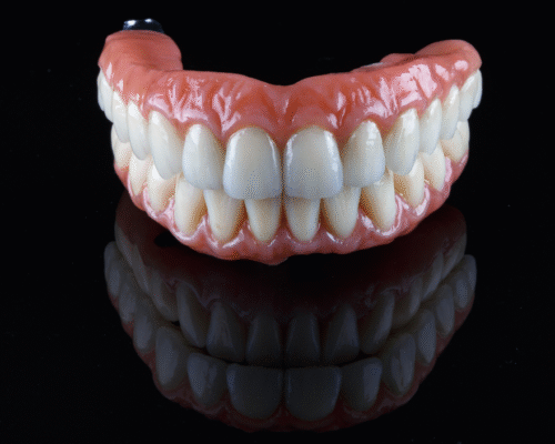 All on Six – Luxurious Stability and Superior Aesthetics of Your Smile