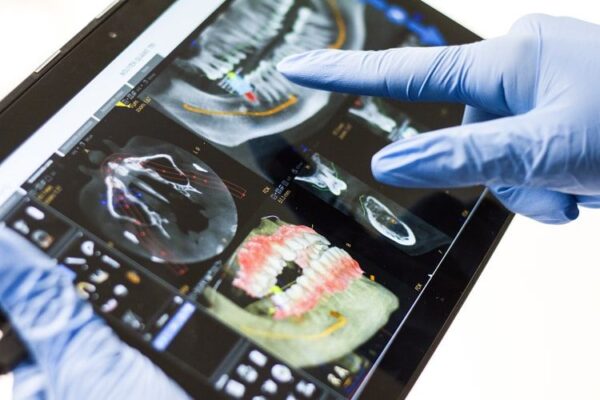 Endodoncija – liječenje kanala korijena zuba
