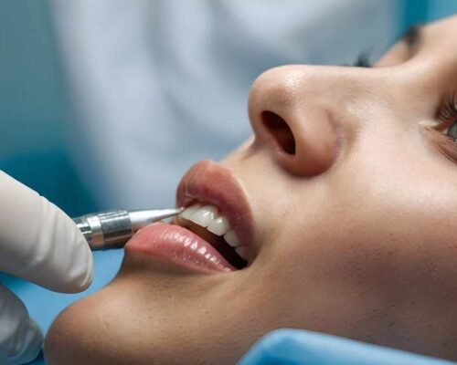 Gum Bleeding – Why It Happens and How to Prevent It
