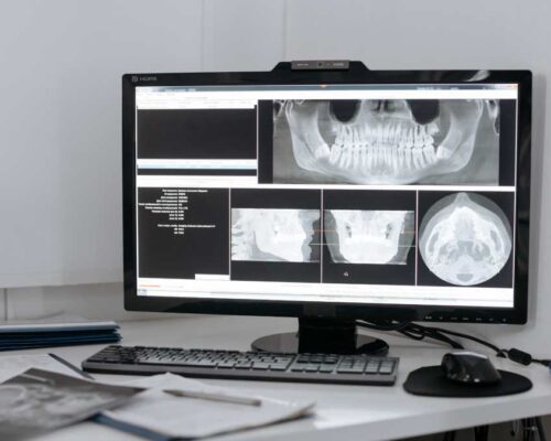 What Is a CBCT 3D Device in Dentistry?