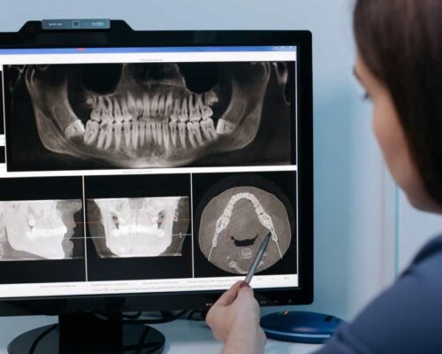 What is Computer-Guided Implantology?