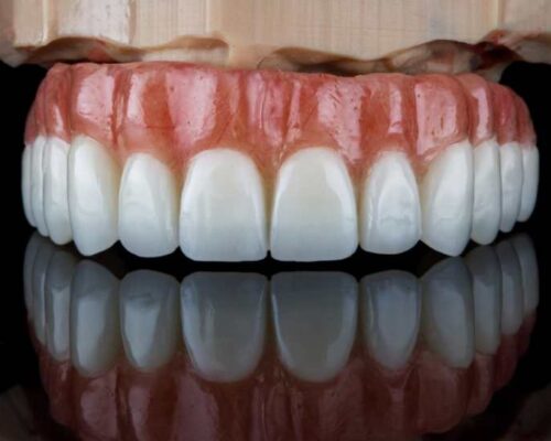Dental Prostheses – What Are They and What Types Exist?