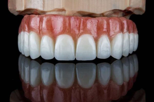 Dental Prostheses – What Are They and What Types Exist?