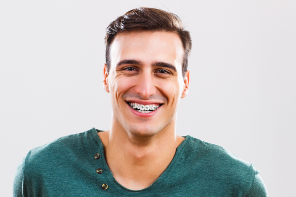 Vse, kar morate vedeti o ortodontiji in zobnih aparatih