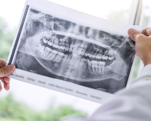 Kako je oralno zdravlje povezano s drugim bolestima?